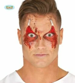 Open Oogleden Wonden